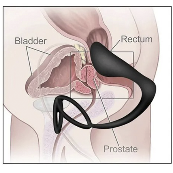 Anillo Cockring & Plug Anal Prostatico